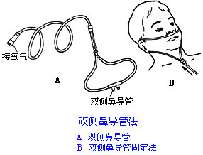 ◆肺病患者如何家庭氧療？